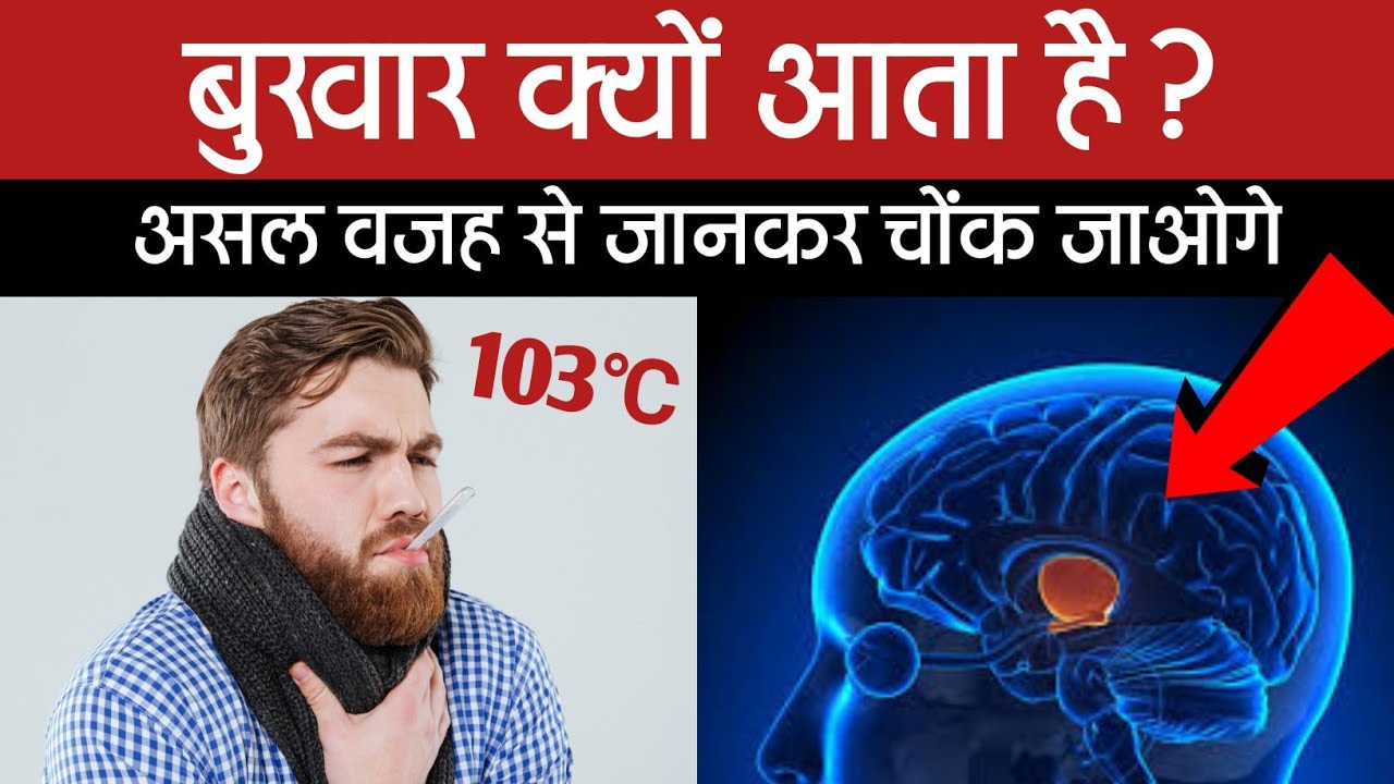 बुखार क्यों आता है जाने इसके पीछे का साइंस | What is the main cause of fever in hindi