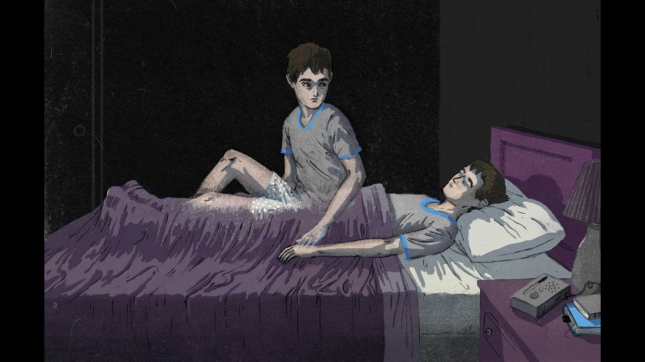 Autoscopic Hallucination | Seeing oneself in subjective space | FCPS part 1 Psychiatry