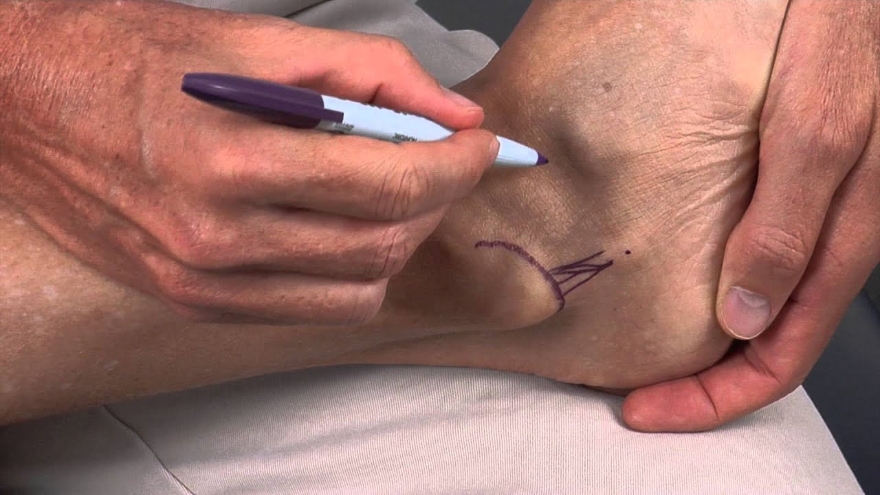 Боковые связки голеностопного сустава