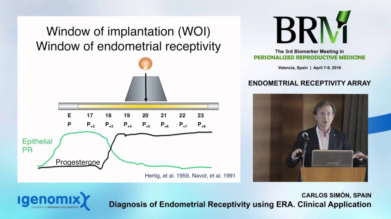 Igenomix - Diagnosis of Endometrial Receptivity using ERA - Prof. Carlos Sim&oacute;n