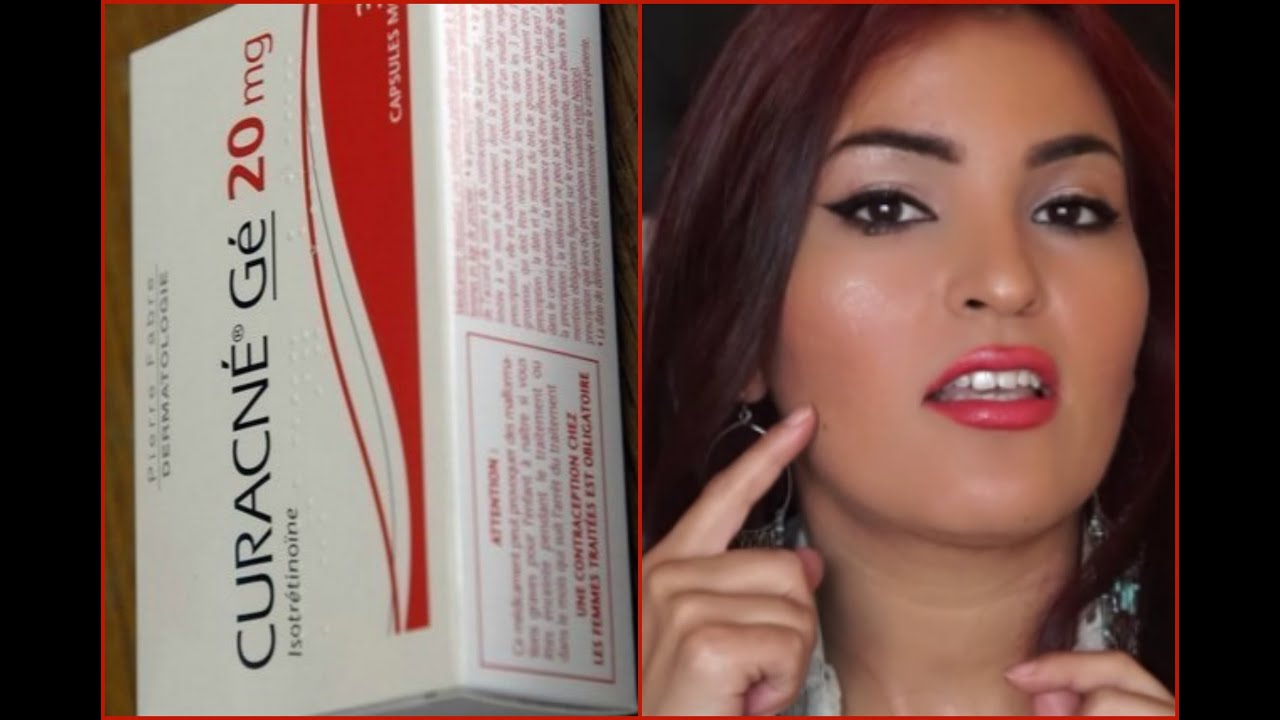 Mon Experience Avec l`Acne et CURACNE