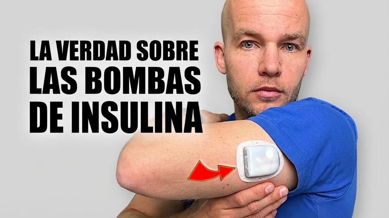 ¡No te pongas una bomba de insulina sin ver esto primero!