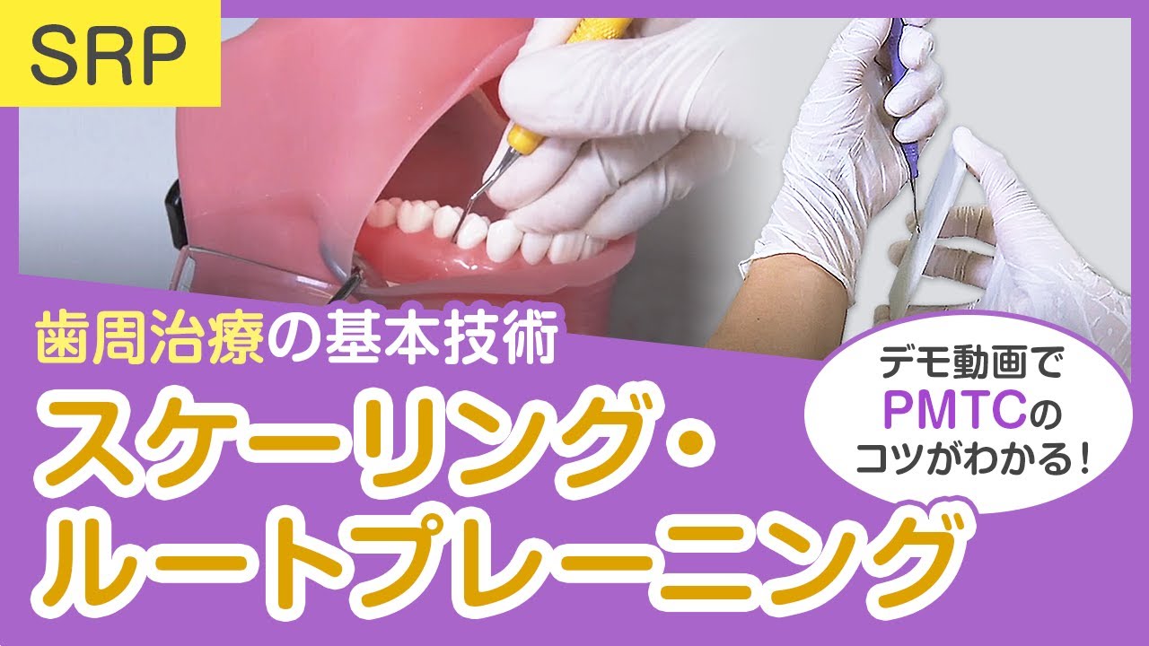 スケーリング・ルートプレーニング