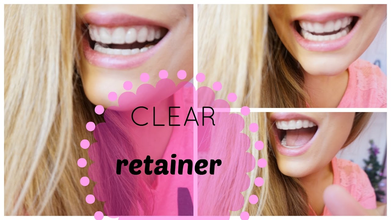 ALL ABOUT MY CLEAR RETAINER!