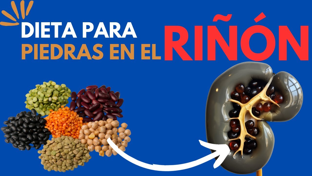 Alimentos para proteger el riñón de piedras
