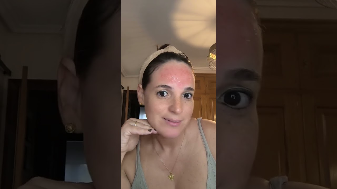 Serum cocunat micro agujas.