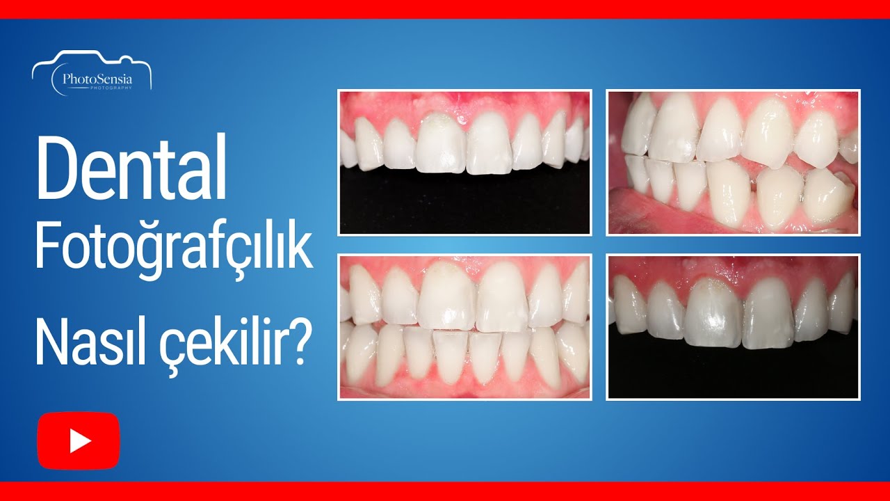 Dental Fotoğrafçılık - Nasıl Çekilir? Dişler Fotoğrafta Nasıl Beyazlatılır?