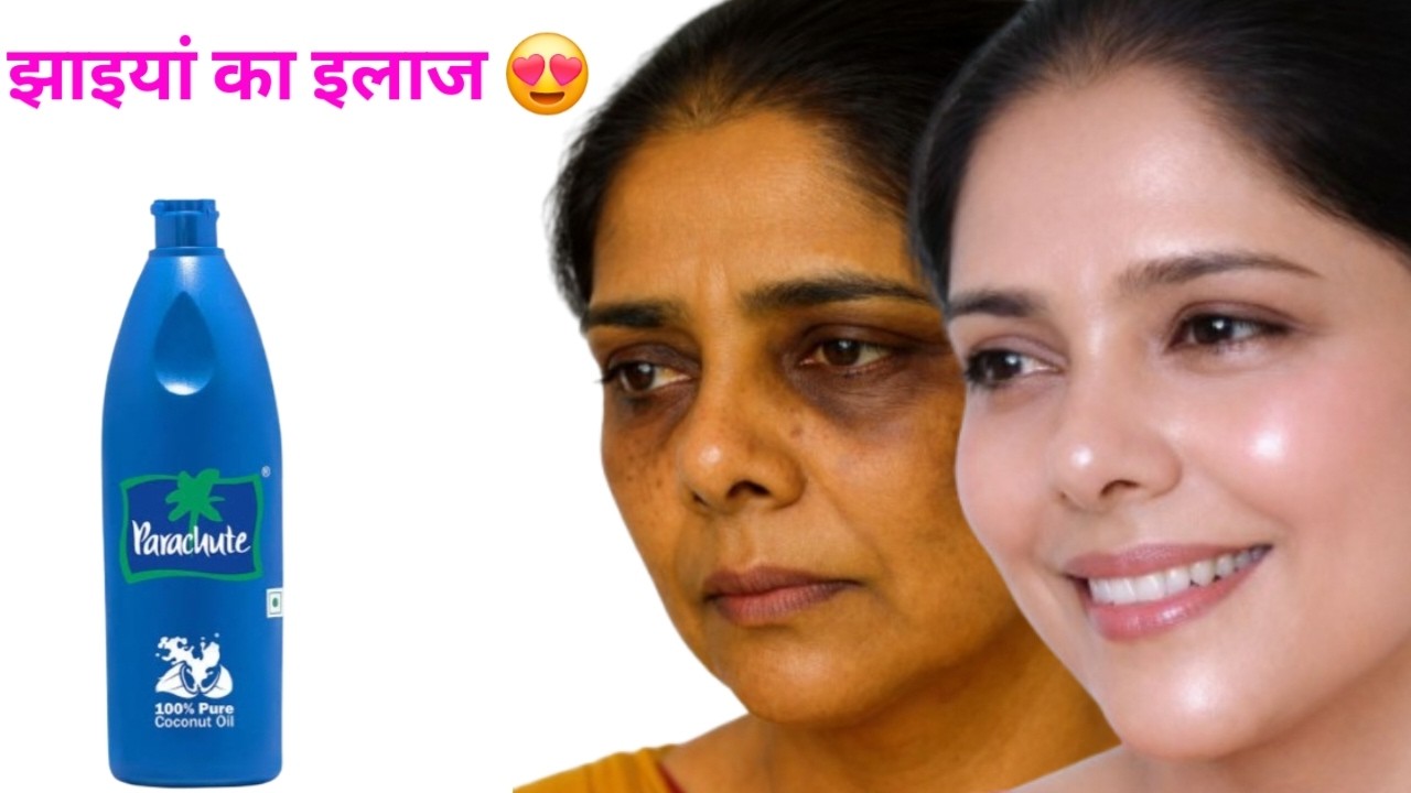 मेरी 10 साल पुरानी झाइयां 2 बार इसे लगाने से चली ही गई,में बहुत गोरी हुई,