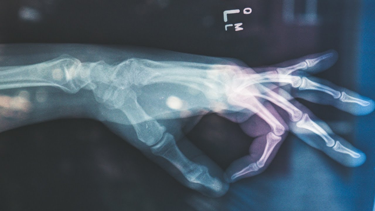 L&I Claim: Industrial Injury Versus Occupational Disease