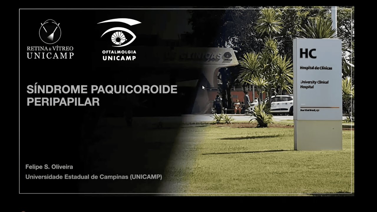 Retina e Vítreo (12/06/2025) - Síndrome Paquicoroide Peripapilar