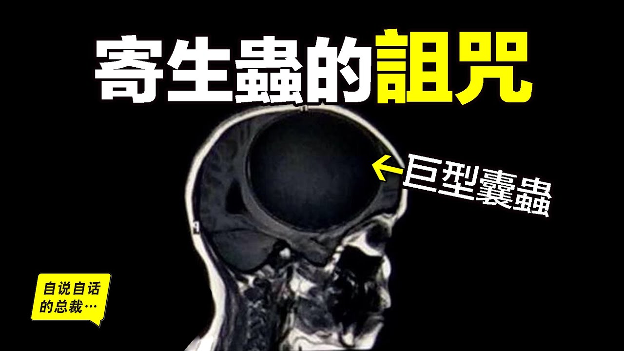大腦中的寄生蟲：最前沿的寄生蟲研究，竟然發現了有關人體免疫的秘密，原來，寄生蟲使用了一個三角詛咒來控制人類&hellip;&hellip;|自說自話的總裁