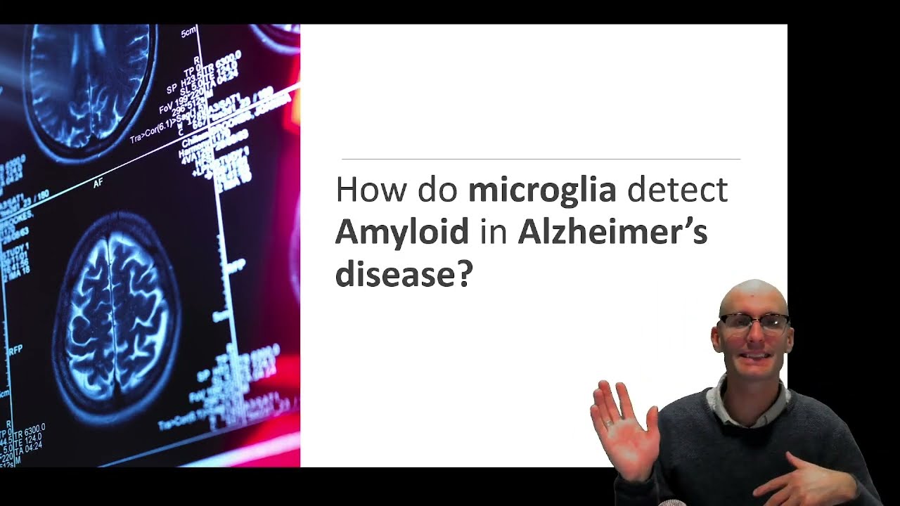 Neuroinflammation in Alzheimer's Disease: How is Amyloid Detected by Microglia?