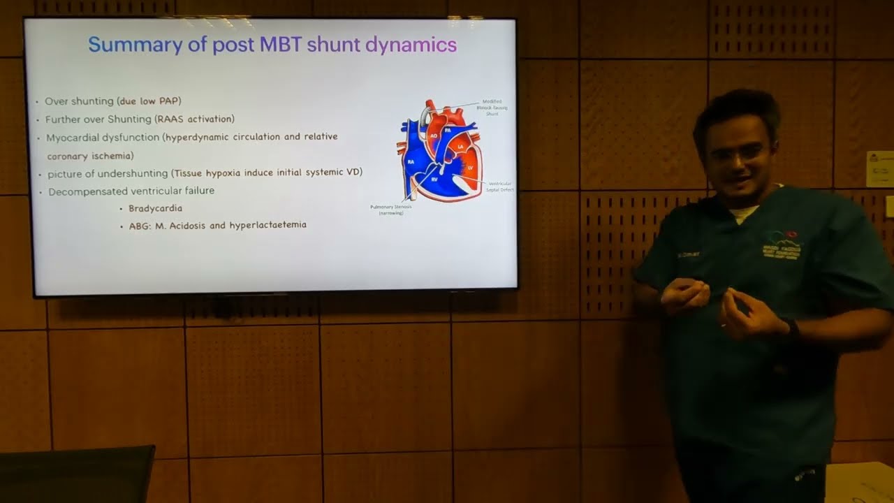Post-op. Management of Single Ventricle - Mostafa Omar