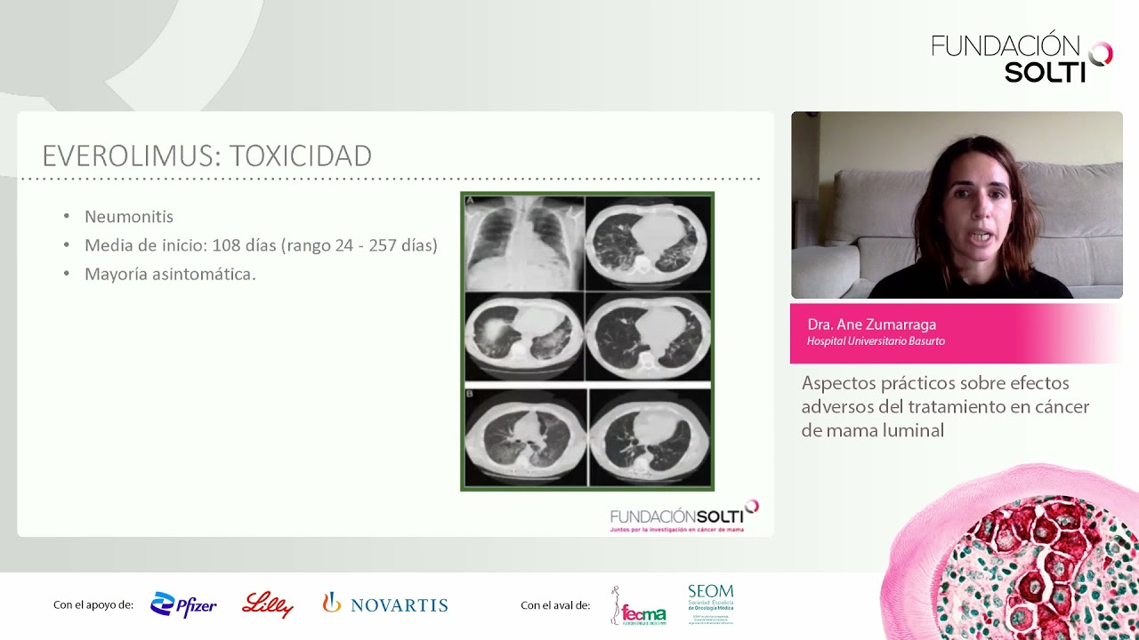 Aspectos prácticos sobre efectos adversos del tratamiento en cáncer de mama luminal