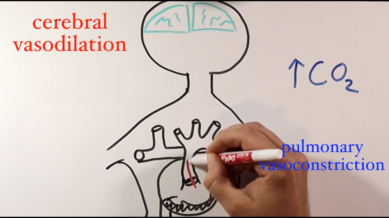 Respiratory management after the Glenn procedure