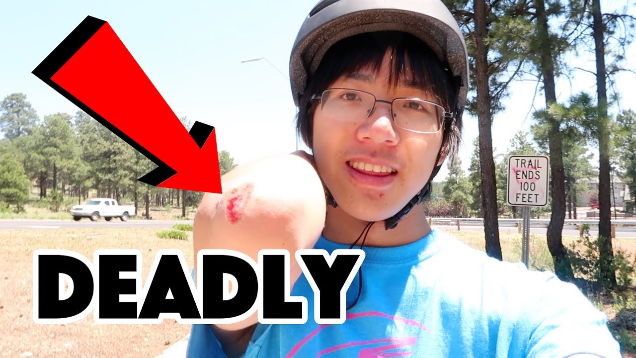 DOING YOUTUBE IS KILLING ME - CLICKBAIT