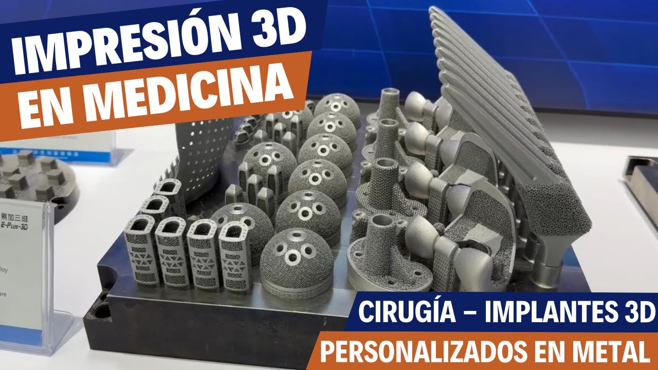 Del diseño 3D al quirófano: así se crean implantes metálicos con impresión 3D en metal