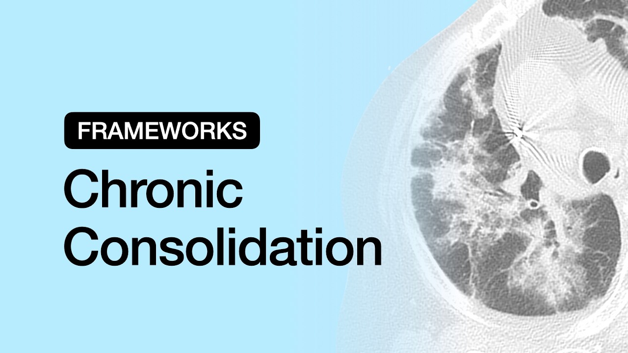 Chronic Consolidation | Chest Radiology Essentials