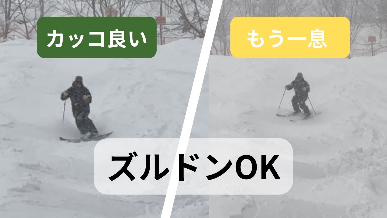 ズルドンはカッコ悪くない｜良いズルドンと悪いズルドンの違い