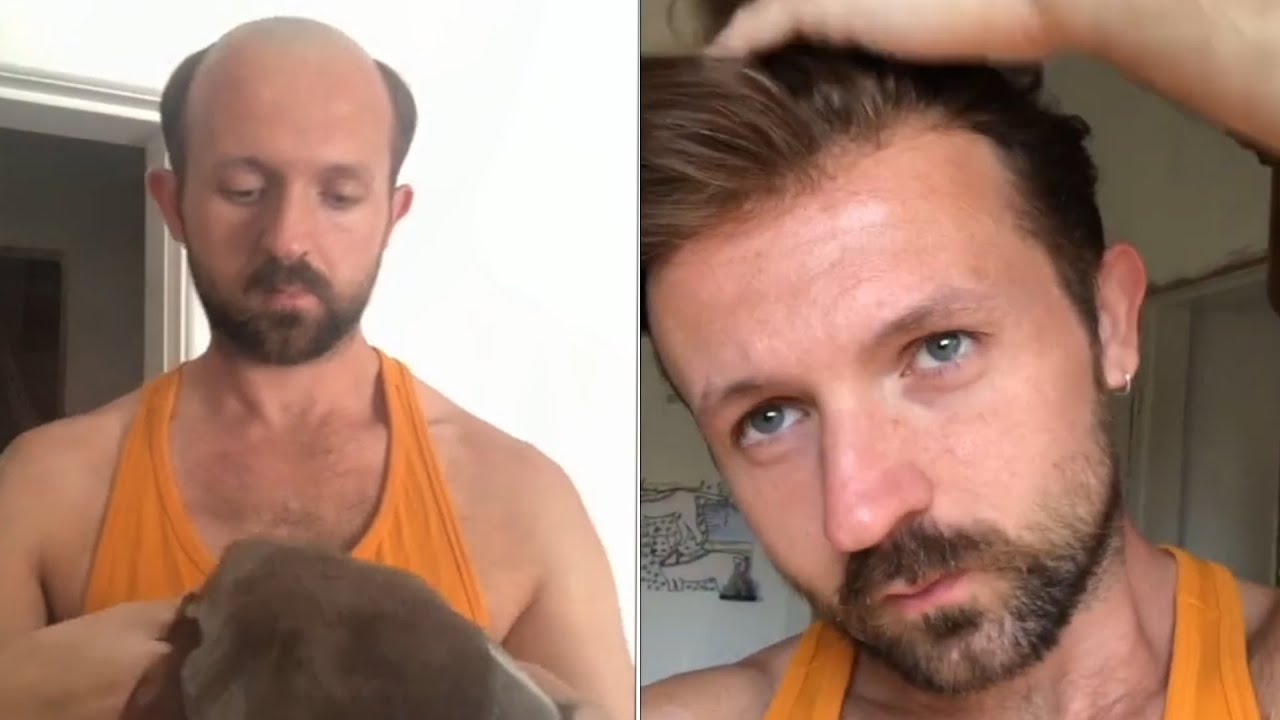 Hair System Tutorial: How to Attach and Style a Men’s Hair System | Lordhair