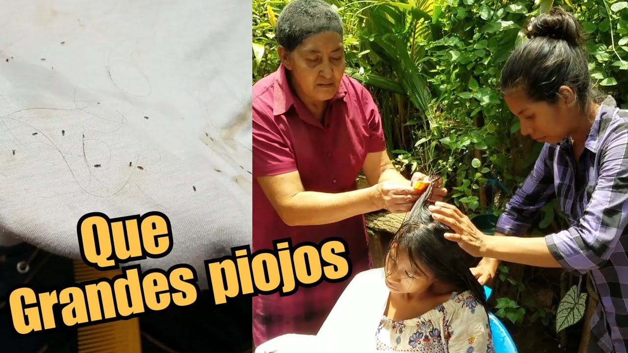 Dios mío! son millones de piojos en la cabeza de esta niña sin quien por ella#3