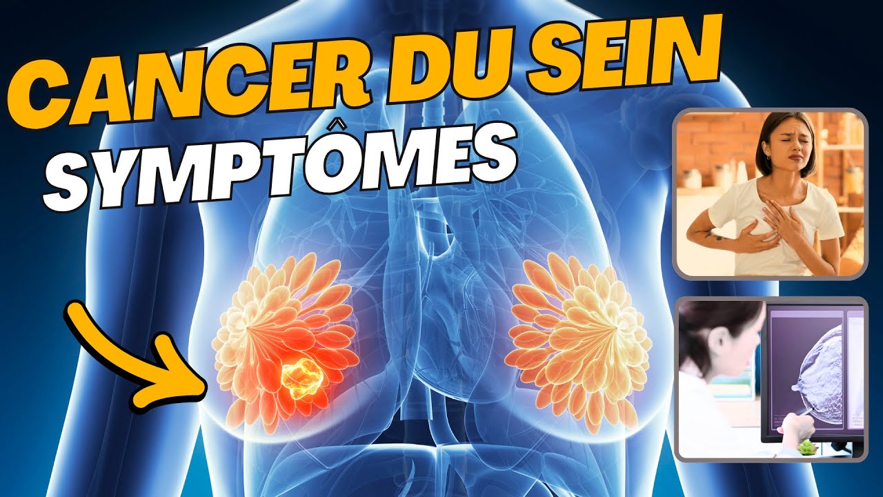 SYMPTÔMES les plus fréquents du CANCER DU SEIN