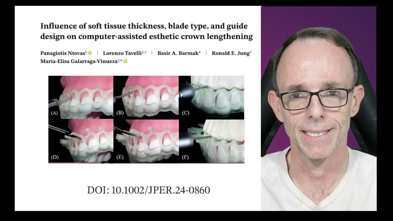 GUIA 3D EM PERIODONTIA REALMENTE IMPORTA?