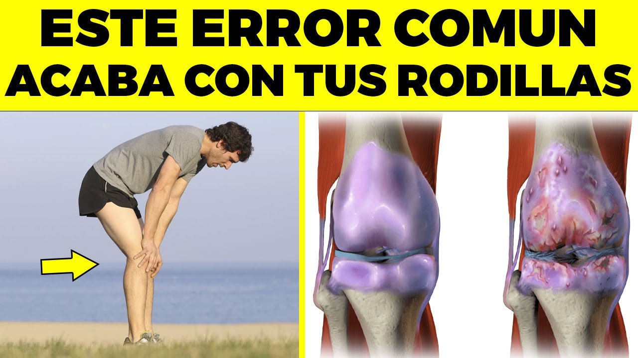 9 malos hábitos por los que tienes DAÑO en tus rodillas