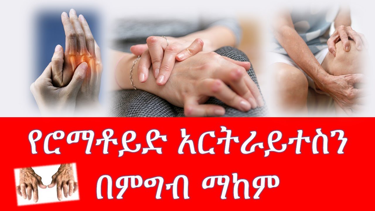 የሮማቶይድ አርትራይተስን በምግብ ማከም /rheumatoid arthritis
