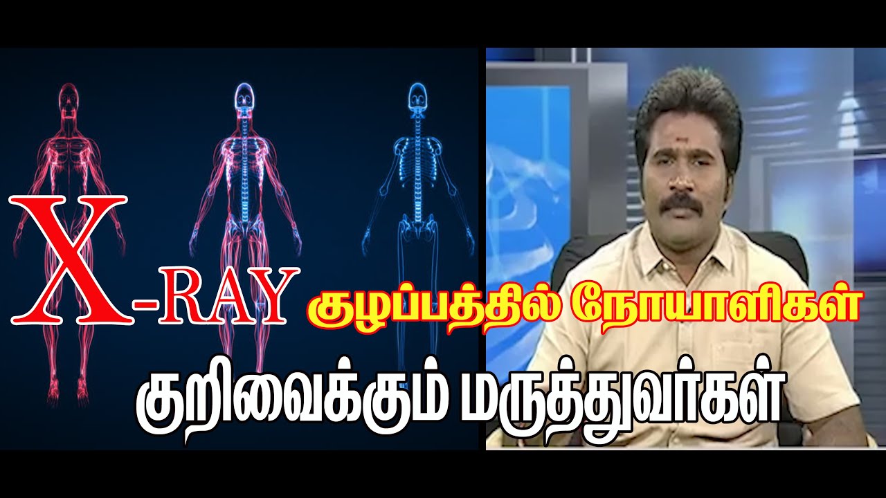Puttur kattu Bonesetting Treatment/எலும்பு முறிவு மருத்துவம்/ மக்களை ஏமாற்றுகிறதா  x ray ?