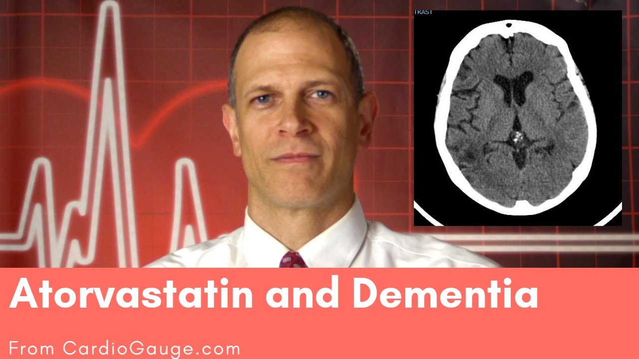 Atorvastatin and Dementia: Do atorvastatin and other statins cause dementia and memory loss?