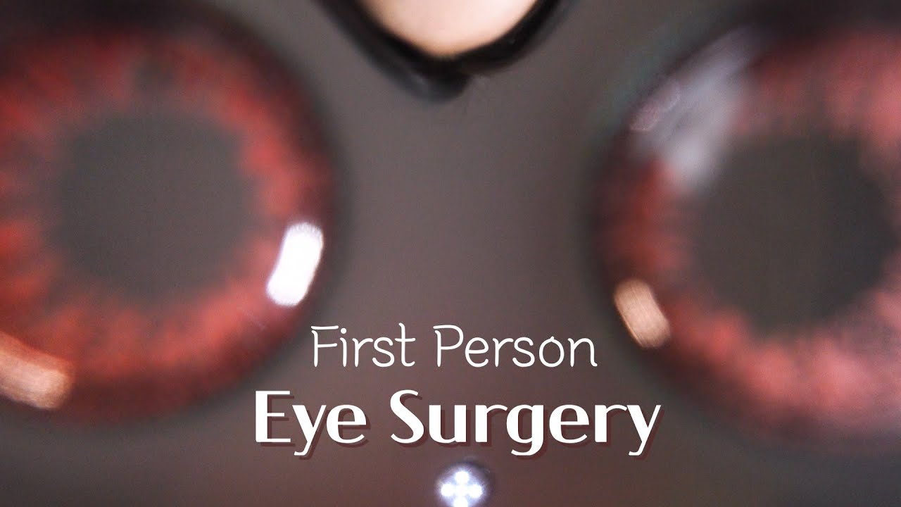 ASMR Get Your Eyesight Corrected 👀 | Eye Surgery (No Talking)