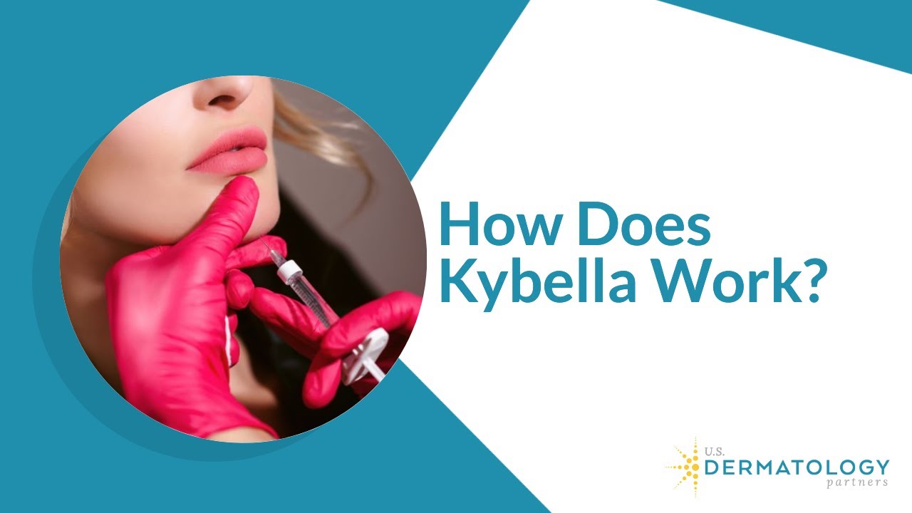Kybella Treatment Explained