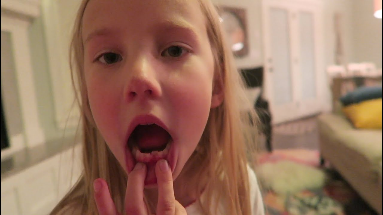 Brielle Loses First Tooth! | Meet The Millers