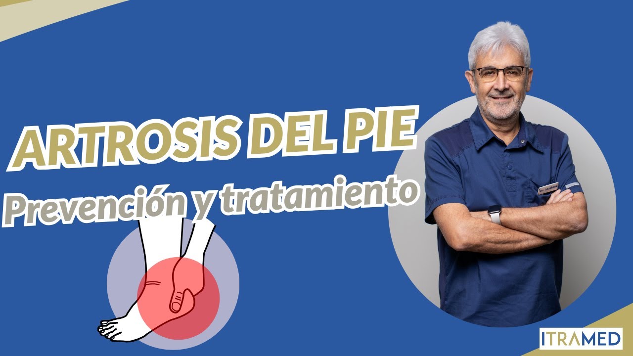 👣 ARTROSIS DEL PIE: Tratamiento, prevención y consejos clave