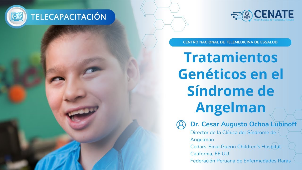 Tratamientos Genéticos en el Síndrome de Angelman