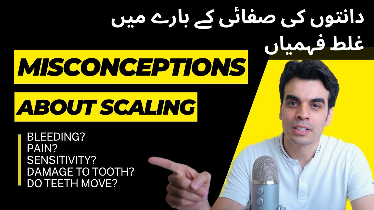 MISCONCEPTIONS ABOUT SCALING/TEETH CLEANING