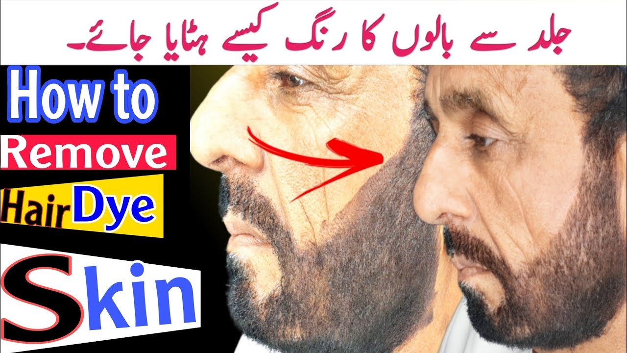 How To Remove Hair Dye From Skin||Skin Remove Hair Dye||How To Remove Beard Colour From Skin||