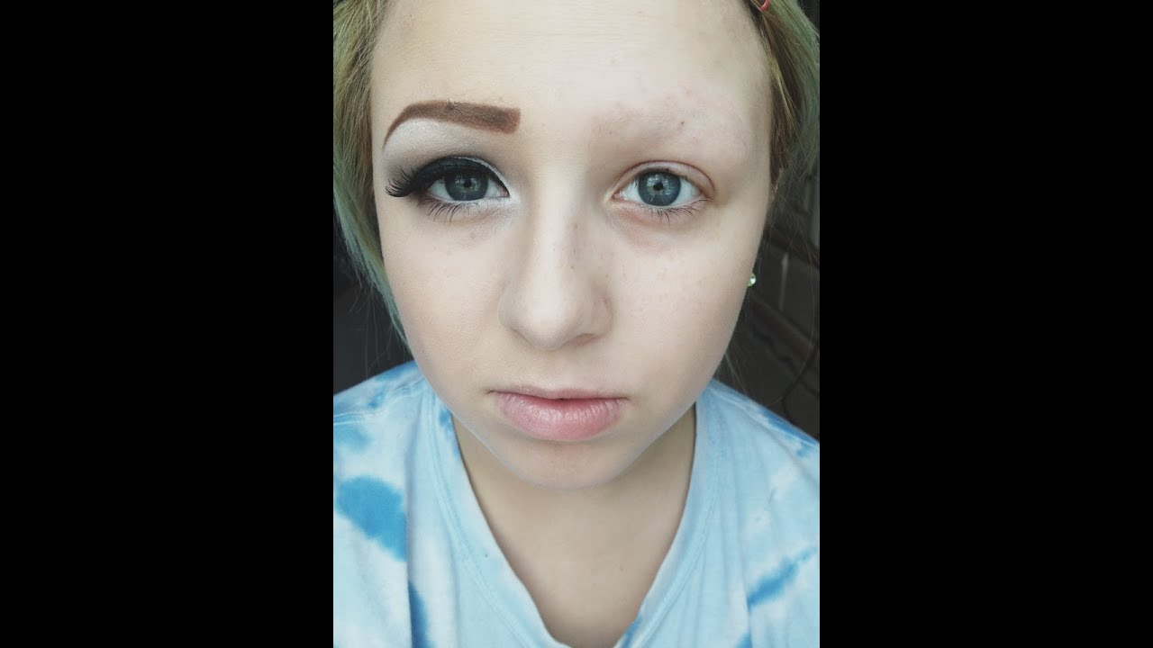 What is Trichotillomania ?