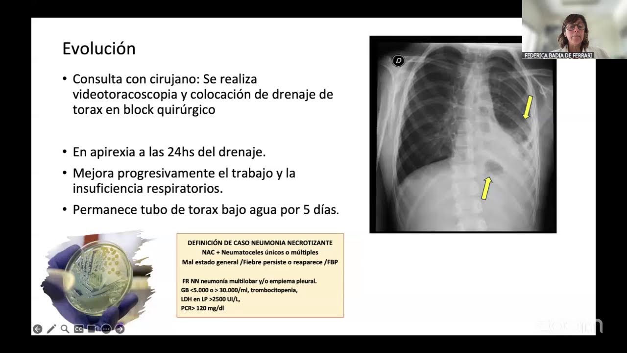 Pediatría 2025 8/10/2025
