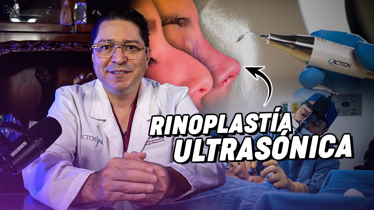 Rinoplastia Ultrasónica ¿Sin dolor? | TODO LO QUE DEBES SABER ANTES DE HACERTE UNA RINOPLASTIA