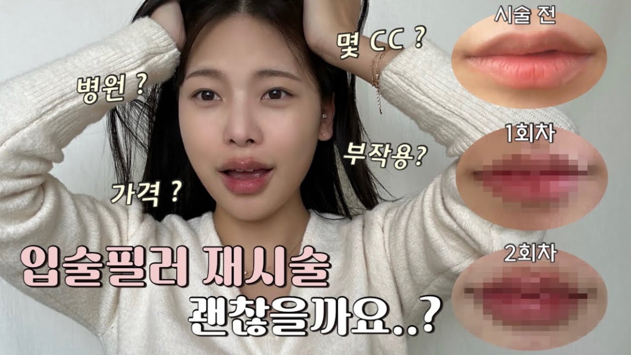 광고X 입술필러 재시술 괜찮을까⁉️ 입술필러 부작용, 입술필러 잘맞는 방법•꿀정보