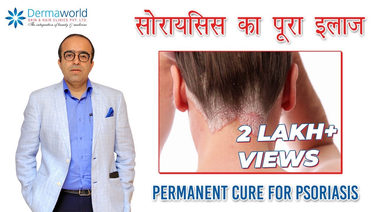सोरायसिस का पूरा इलाज | Permanent Cure for Psoriasis | Dr Rohit Batra | In Hindi