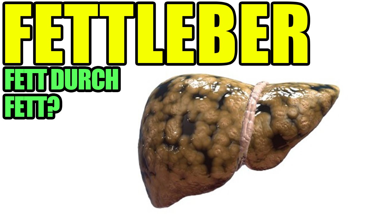 FETTLEBER - fette Leber durch Fett? | Insulinresistenz & Diabetes auf dem Vormarsch