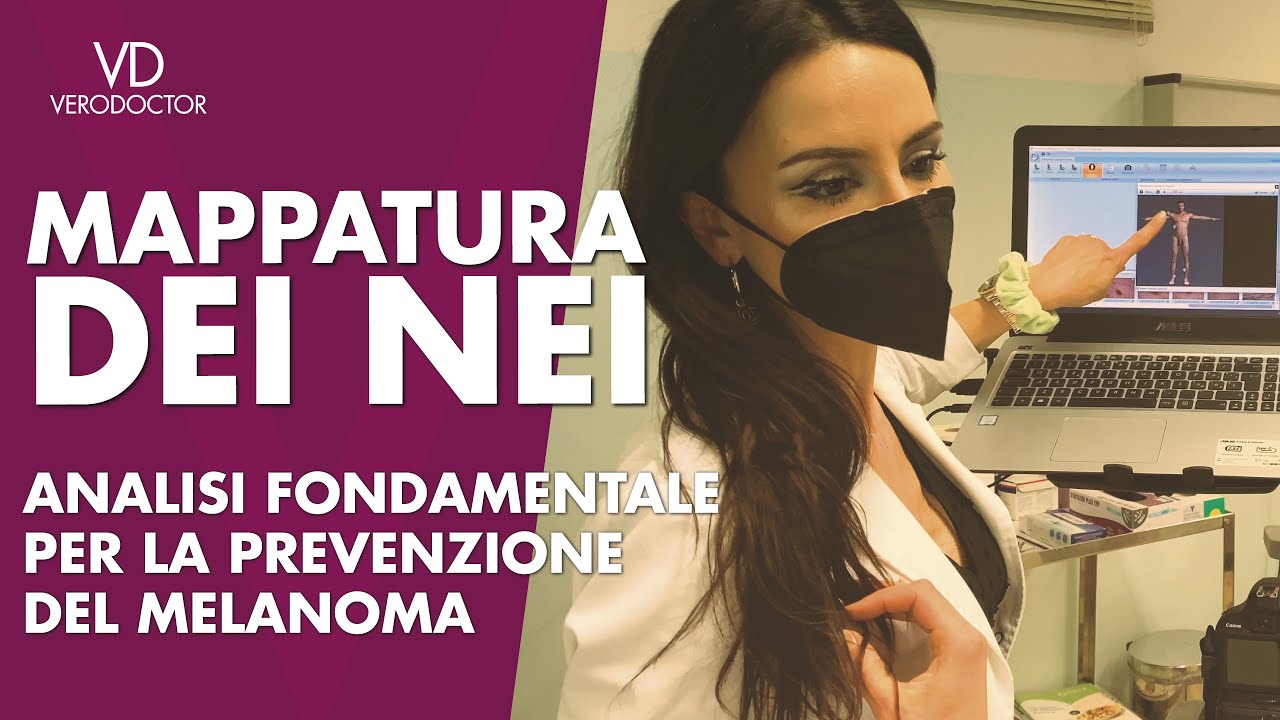 La Mappatura dei nei, analisi fondamentale per la prevenzione del melanoma - VERODOCTOR