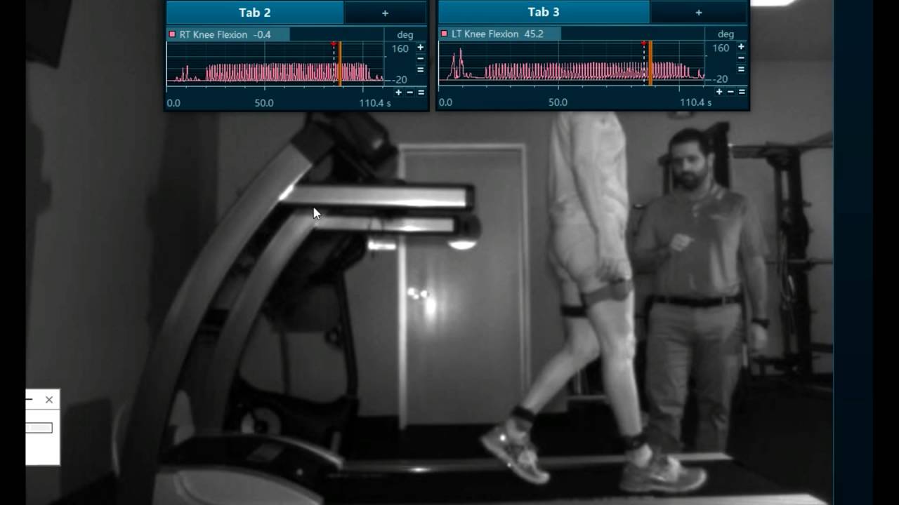 Quadriceps Avoidance: Walking Gait Analysis