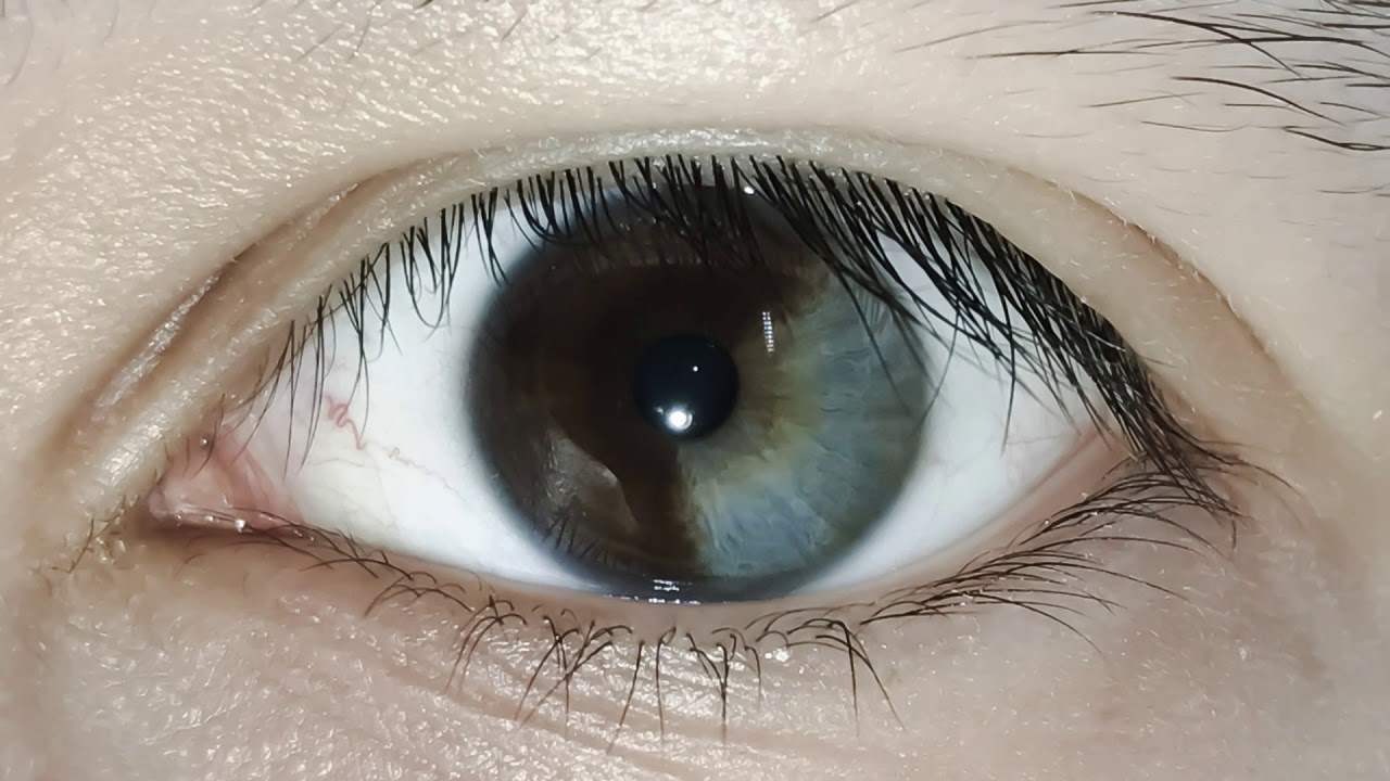 Requested Increase Melanin In Eyes | Get Darker Eyes Fast Biokinesis Subliminal