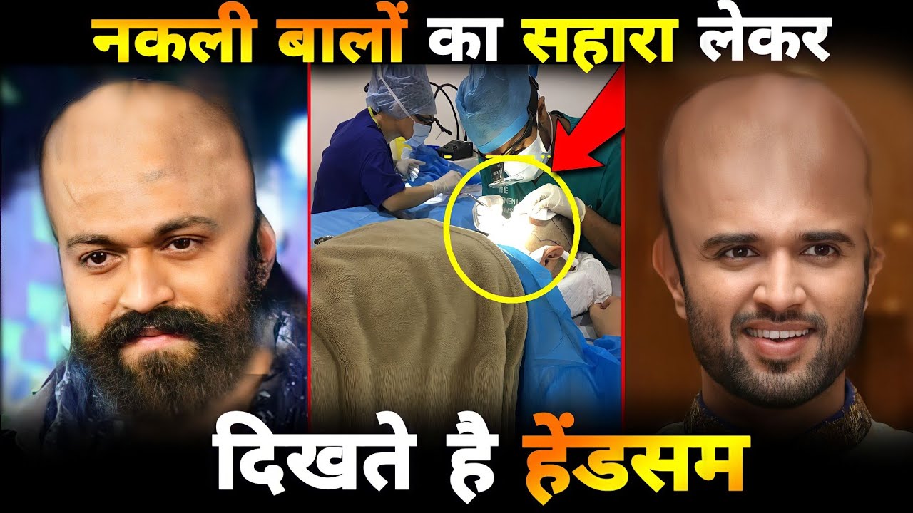 साउथ इंडस्ट्री में सुपरस्टार कहे जाने वाले यह सभी अभिनेता जीते हैं नकली बालों का सहारा लेकर TOP 5