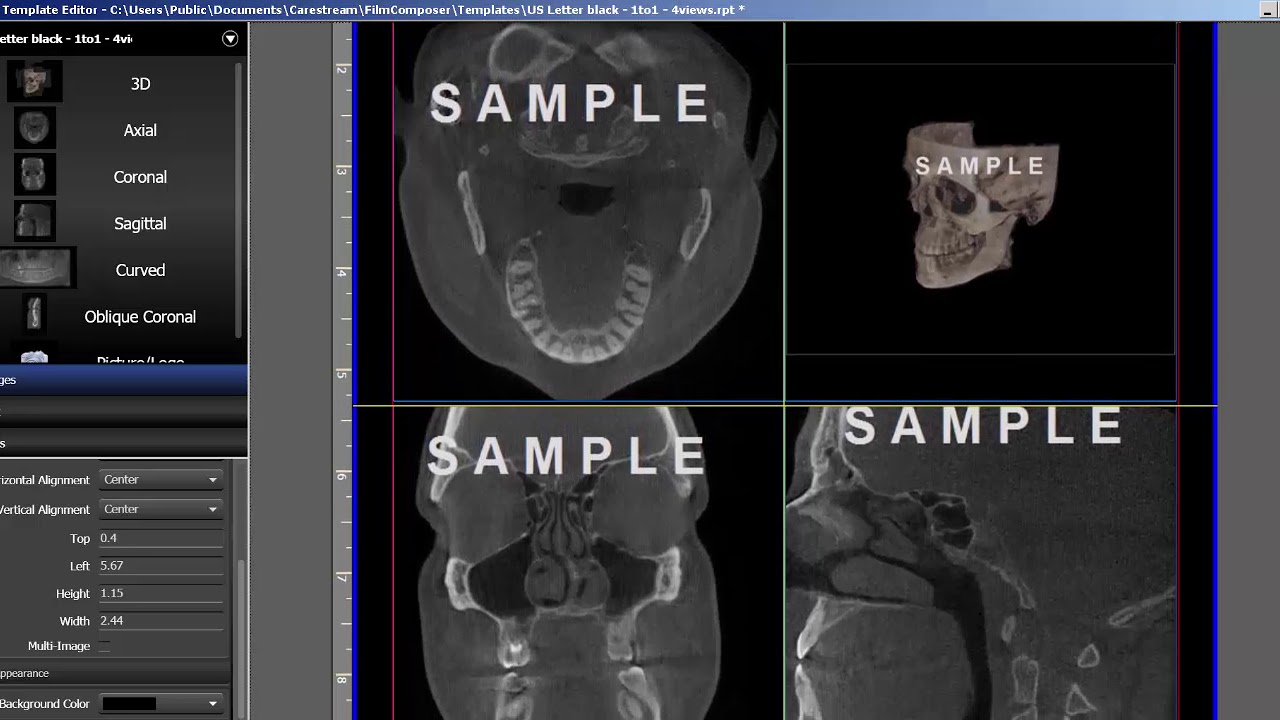CS 3D Imaging Editing Templates with the Template Editor