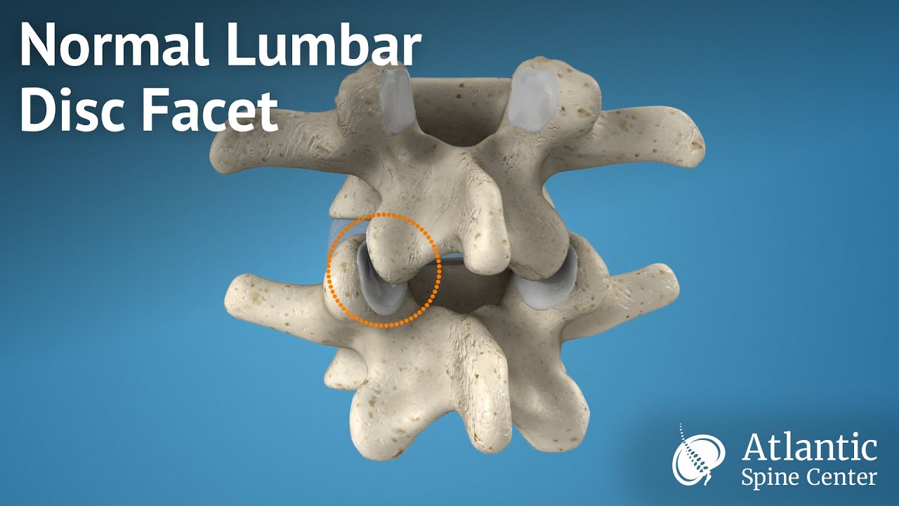Normal Lumbar Disc Facet